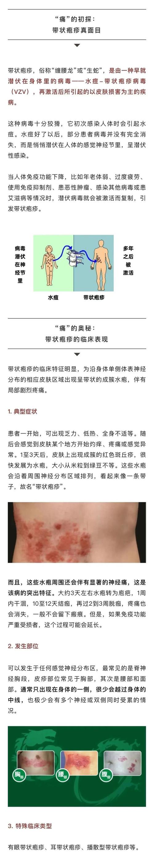 一旦感染终身携带，疼起来想死的心都有”这4类人要警惕！