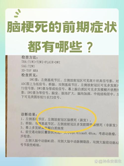 人不会无缘无故患脑梗塞！医生调查发现：得脑梗塞，离不开这4点