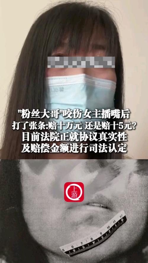 郑州一男子咬伤女主播的嘴，赔偿“十万元”变成“十5元”