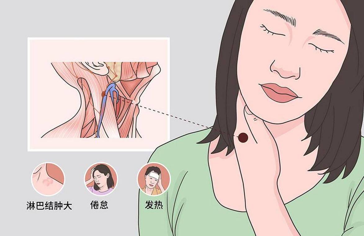 浙江大学发现：体内有恶性肿瘤的人，身体一般或可能有6个表现？
